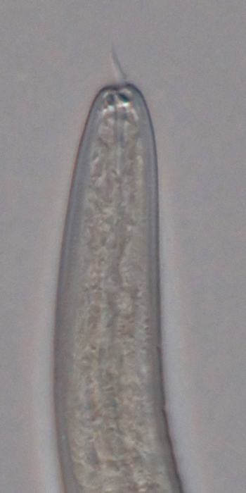 Paratype male anterior end