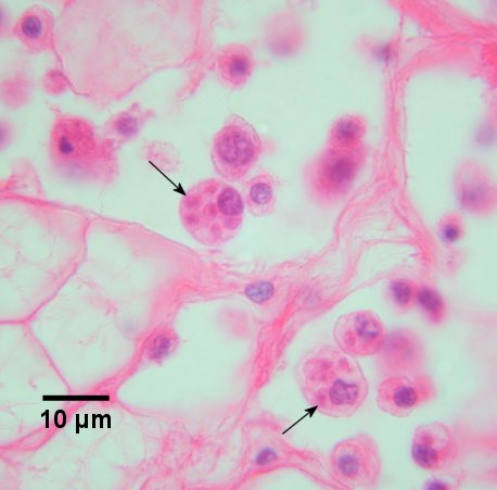 oesterparasiet Bonamia ostreae