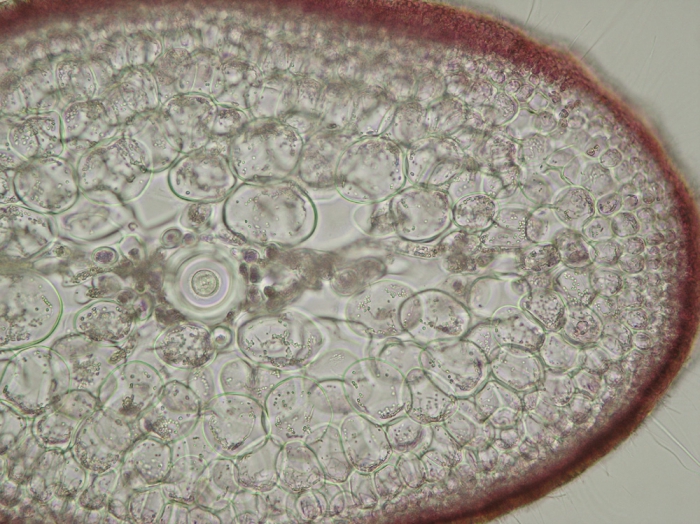 Sphaerococcus coronopifolius Sphaerococcus coronopifolius