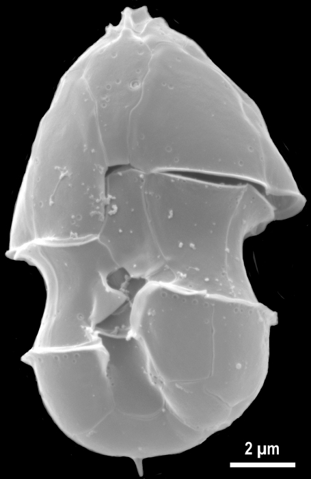 Azadinium spinosum, SEM provided by Urban Tillmann