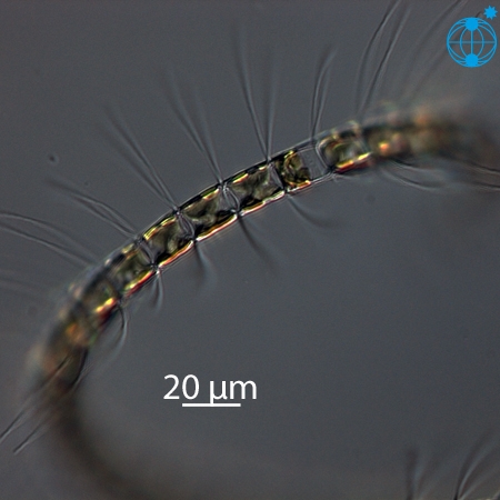 Chaetoceros pseudocurvisetus Chaetoceros pseudocurvisetus