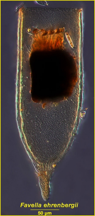 Favella ehrenbergii (Claparéde & Laachmann, 1858) 