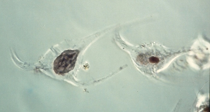 Amoebophyra ceratii in host Ceratium longipes Amoebophyra ceratii in host Ceratium longipes