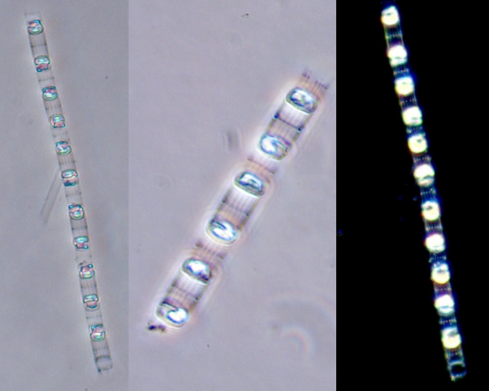 Skeletonema costatum Skeletonema costatum