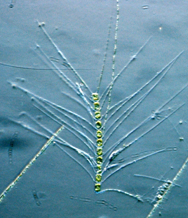 Chaetoceros concavicornis Chaetoceros concavicornis