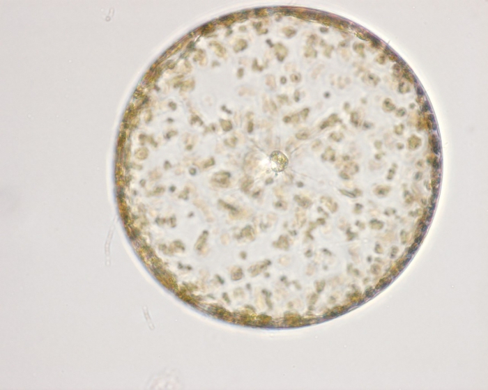 Coscinodiscus granii Coscinodiscus granii