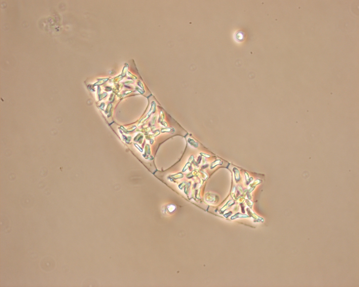 Eucampia zoodiacus Eucampia zoodiacus