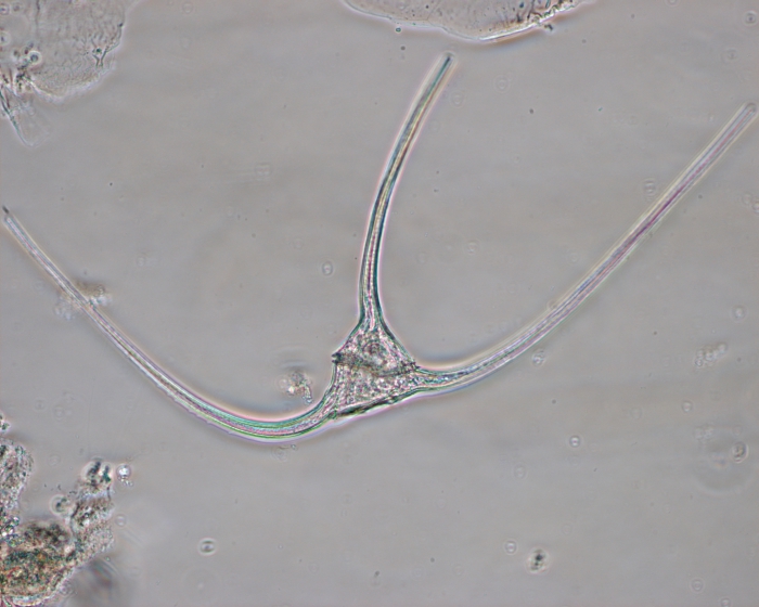 Ceratium