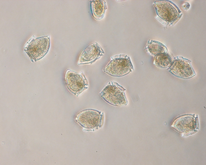 Dinophysis