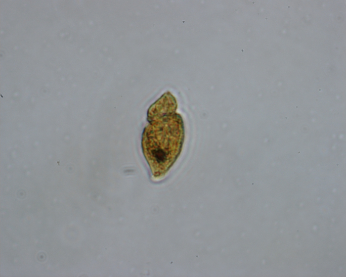 Katodinium glaucum
