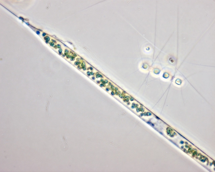 Rhizosolenia setigera Rhizosolenia setigera