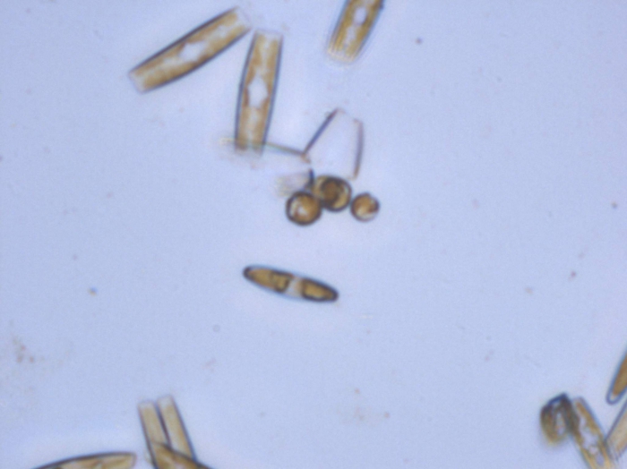 Tabularia fasciculata (C.A. Agardh) Williams & Round Tabularia fasciculata (C.A. Agardh) Williams & Round
