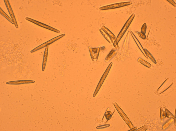 Tabularia fasciculata (C.A. Agardh) Williams & Round Tabularia fasciculata (C.A. Agardh) Williams & Round