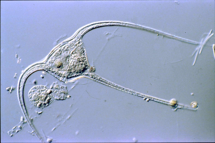 Ceratium longipes