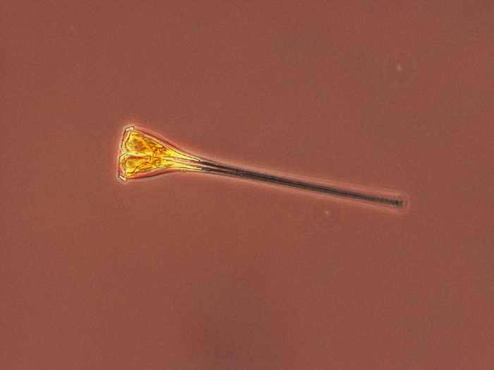 Asterionellopsis glacialis Asterionellopsis glacialis