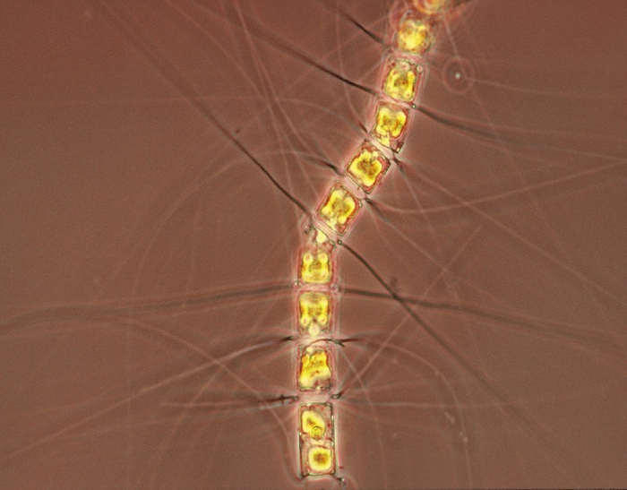 Chaetoceros cinctus Chaetoceros cinctus