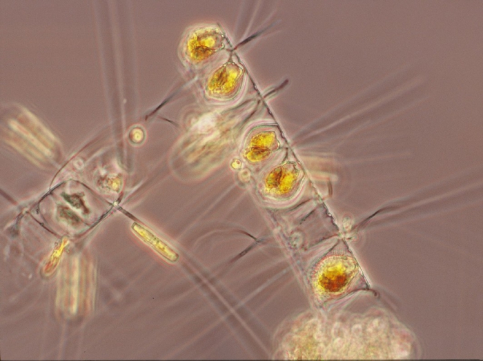 Chaetoceros constrictus with resting stages Chaetoceros constrictus with resting stages