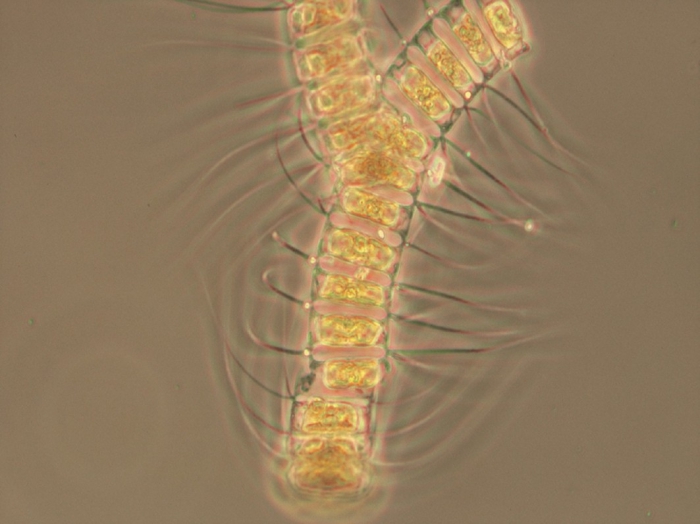Chaetoceros debilis Chaetoceros debilis