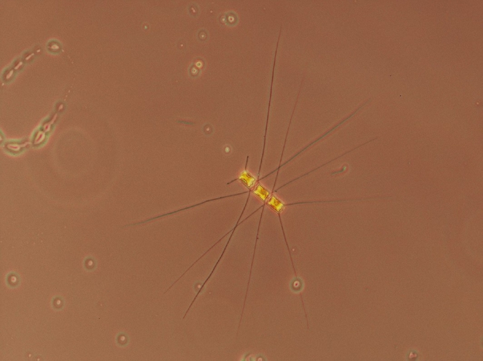 Chaetoceros similis Chaetoceros similis