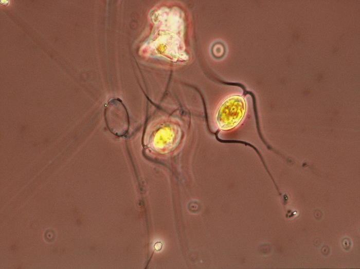 Chaetoceros cinctus valve view Chaetoceros cinctus valve view