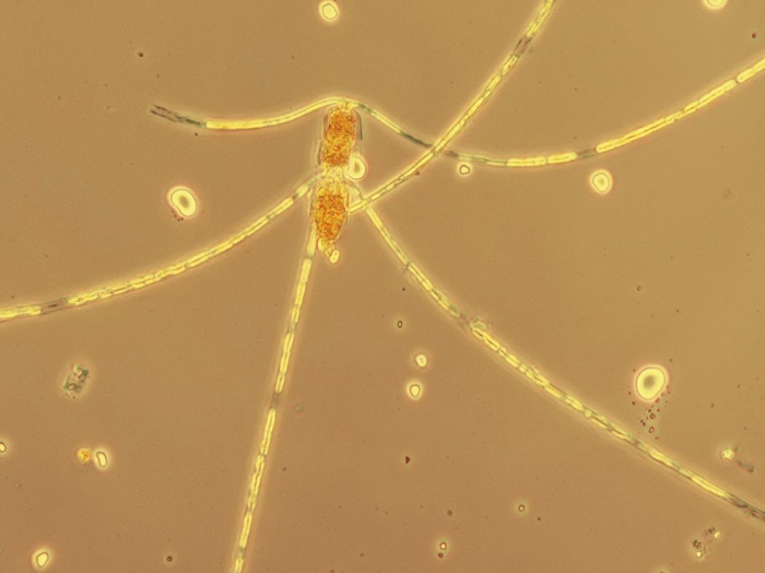 Chaetoceros concavicornis Chaetoceros concavicornis
