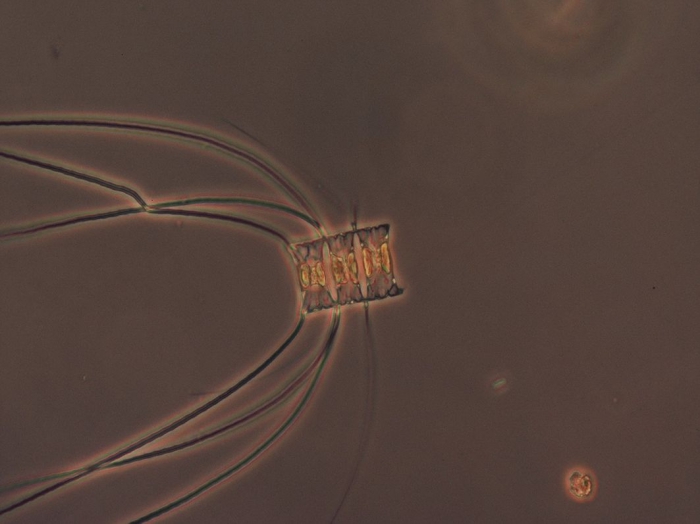 Chaetoceros constrictus Chaetoceros constrictus