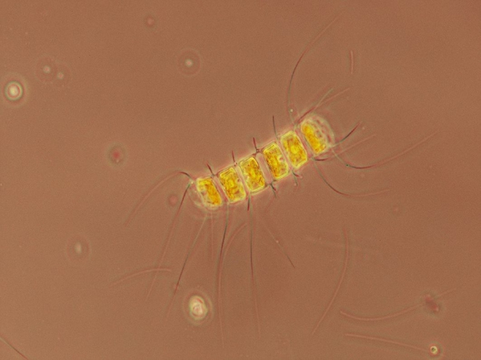 Chaetoceros debilis Chaetoceros debilis