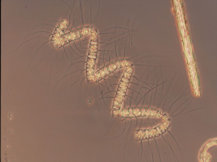 Chaetoceros debilis chain Chaetoceros debilis chain