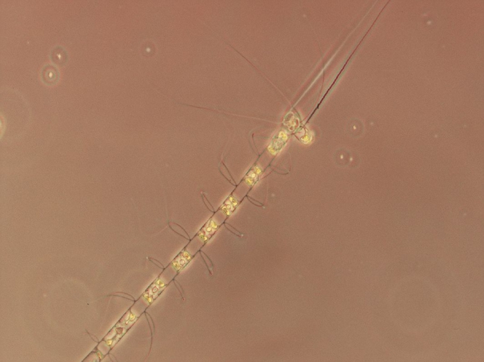 Chaetoceros laciniosus Chaetoceros laciniosus