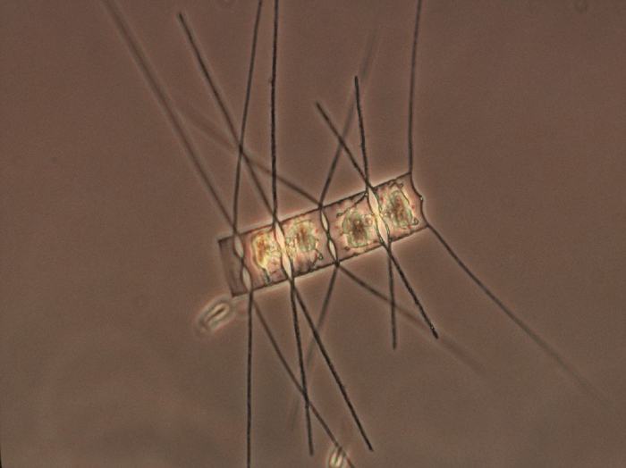 Chaetoceros similis Chaetoceros similis
