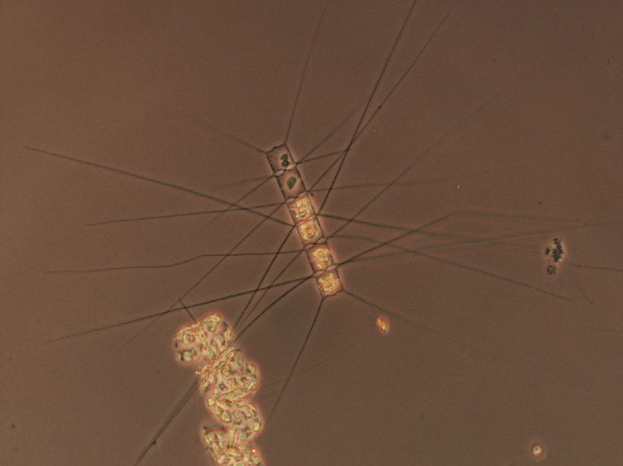 Chaetoceros similis Chaetoceros similis