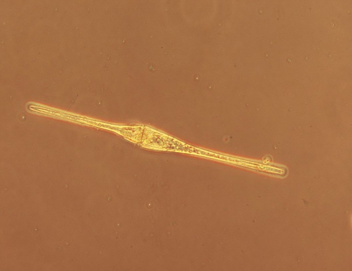 Ceratium fusus