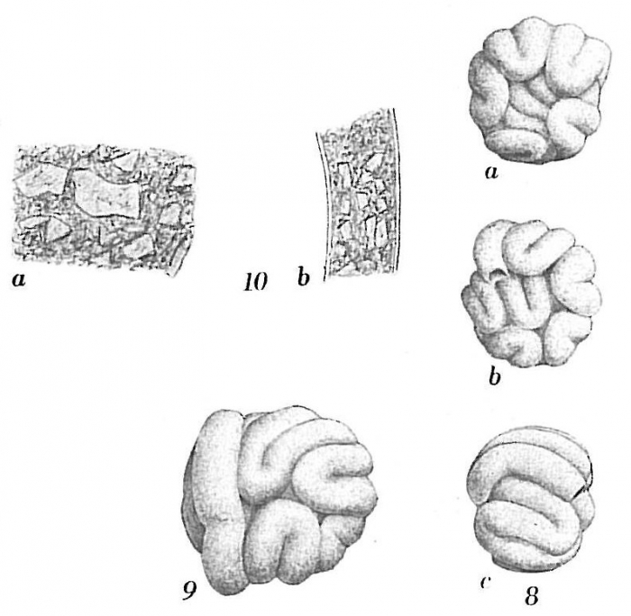 Glomospira glomerata