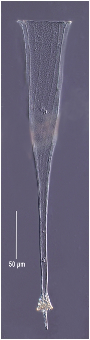Lorica of Rhabdonellopsis longicaulis Lorica of Rhabdonellopsis longicaulis