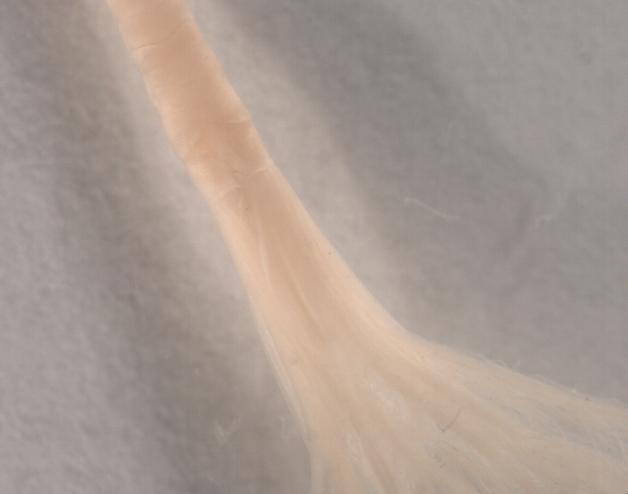 Euchone sp.