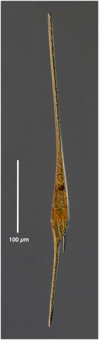 Neoceratium fusus or Ceratium fusus Neoceratium fusus or Ceratium fusus