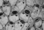 Coronellina fagei, Lectotype: MNHN 8777, NE Atlantic Coronellina fagei, Lectotype: MNHN 8777, NE Atlantic