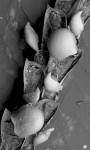 Kinetoskias cyathus, syntype Kinetoskias cyathus, syntype