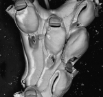 Notoplites jeffreysii, NW Iberian Peninsula Notoplites jeffreysii, NW Iberian Peninsula