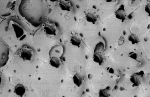 Schizotheca carmine, Holotype: MNHN 7426 Schizotheca carmine, Holotype: MNHN 7426