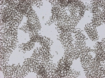 Microcystis aeruginosa 100x