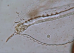 Agalma elegans athorybiid larva larval tentacle tip
