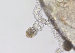 Nanomia bijuga siphonula larva detail, larval tentillum
