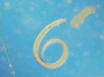 Nematoda (roundworms)