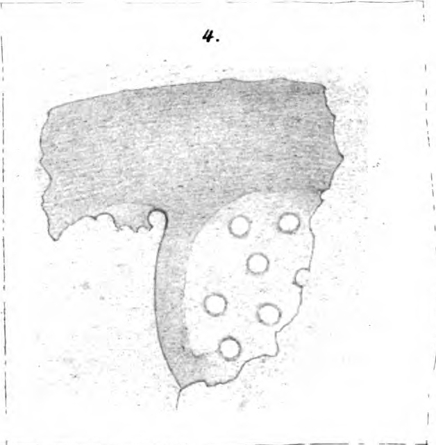 Anomalina cicatricosa Schwager, 1866
