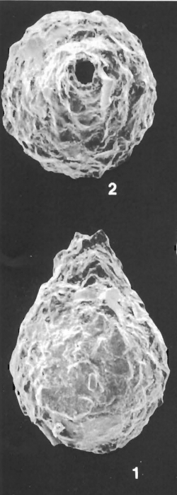 Lagenammina pacifica Hofker identified specimen Lagenammina pacifica Hofker identified specimen