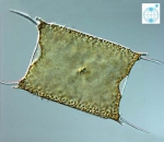 Odontella sinensis Odontella sinensis