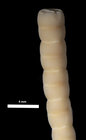 Zeuctocrinus gisleni AM Clark, 1973 HOLO BMNH 1972.12.5.4
