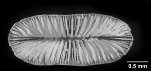 Truncatoflabellum spheniscus, calicular view