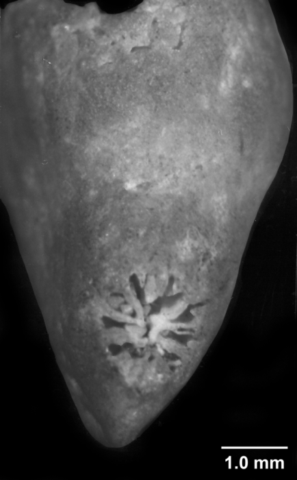Premocyathus dentiformis, basal view